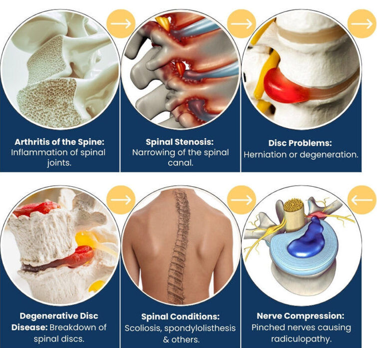 Lumbar spine and back pain